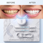 Professional LED Teeth Whitening Kit